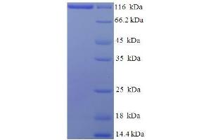 SDS-PAGE (SDS) image for Major Vault Protein (MVP) (AA 2-893) protein (His-SUMO Tag) (ABIN5709981) (MVP Protein (AA 2-893) (His-SUMO Tag))