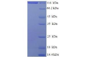 SDS-PAGE (SDS) image for Major Vault Protein (MVP) (AA 2-893) protein (His-SUMO Tag) (ABIN4976034) (MVP Protein (AA 2-893) (His-SUMO Tag))