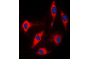 Immunofluorescent analysis of ARHGAP17 staining in Lovo cells. (ARHGAP17 antibody  (Center))