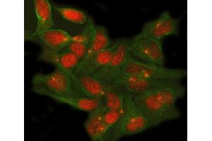 anti-Teashirt Zinc Finger Homeobox 1 (TSHZ1) (AA 97-800) antibody