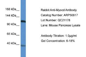 WB Suggested Anti-Myocd Antibody   Titration: 1. (Myocardin antibody  (N-Term))