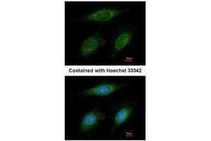ICC/IF Image Immunofluorescence analysis of methanol-fixed HeLa, using RNF6, antibody at 1:200 dilution. (RNF6 antibody  (C-Term))
