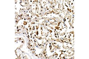 Immunohistochemistry of paraffin-embedded human lung using BHLHE40 Rabbit pAb (ABIN6129354, ABIN6137550, ABIN6137551 and ABIN6222195) at dilution of 1:150 (40x lens). (BHLHE40 antibody  (AA 173-412))