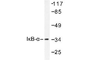 Image no. 1 for anti-Nuclear Factor of kappa Light Polypeptide Gene Enhancer in B-Cells Inhibitor, alpha (NFKBIA) antibody (ABIN265483) (NFKBIA antibody)