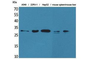 Western Blotting (WB) image for anti-Tumor Necrosis Factor (Ligand) Superfamily, Member 13b (TNFSF13B) (Internal Region) antibody (ABIN3187708)