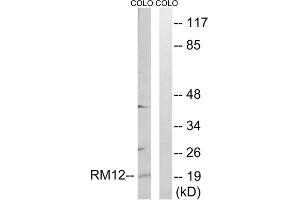 Western blot analysis of extracts from COLO cells, using MRPL12 antibody. (MRPL12 antibody  (Internal Region))