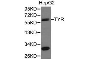 Western Blotting (WB) image for anti-Tyrosinase (TYR) antibody (ABIN1875241) (TYR antibody)
