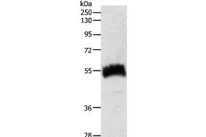 Western Blot analysis of Human fetal kidney tissue using SLC22A6 Polyclonal Antibody at dilution of 1:600 (SLC22A6 antibody)