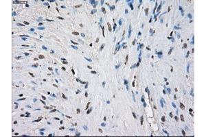 Image no. 6 for anti-Fc gamma RII (CD32) antibody (ABIN1497255) (Fc gamma RII (CD32) antibody)