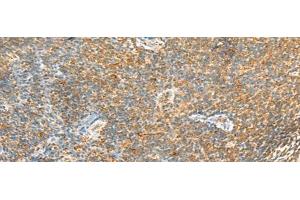 Immunohistochemistry of paraffin-embedded Human tonsil tissue using MTHFD2L Polyclonal Antibody at dilution of 1:30(x200) (MTHFD2L antibody)