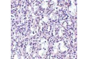 Immunohistochemistry of Carabin in human spleen tissue with Carabin antibody at 2. (Carabin antibody  (N-Term))