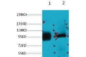 Western Blot (WB) analysis of 1) HeLa, 2) 293T, diluted at 1:2000. (ABCB5 antibody)
