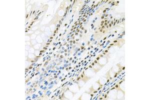 Immunohistochemistry of paraffin-embedded human colon using MAPK8 antibody. (JNK antibody)