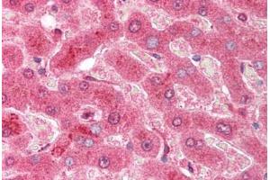Human Liver (formalin-fixed, paraffin-embedded) stained with CASP3 antibody ABIN214076 at 10 ug/ml followed by biotinylated goat anti-rabbit IgG secondary antibody ABIN481713, alkaline phosphatase-streptavidin and chromogen. (Caspase 3 antibody  (AA 166-183))