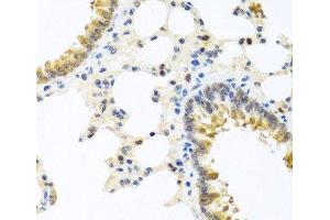 Immunohistochemistry of paraffin-embedded Rat lung using WNT9A Polyclonal Antibody at dilution of 1:100 (40x lens). (WNT9A antibody)