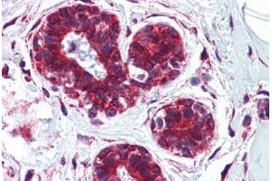 Human Breast: Formalin-Fixed, Paraffin-Embedded (FFPE) (CKAP4 antibody  (AA 216-265))