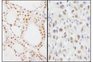 Immunohistochemistry (IHC) image for anti-Zinc Finger Protein 335 (ZNF335) (AA 300-350) antibody (ABIN7453935)