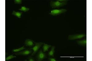 Immunofluorescence of purified MaxPab antibody to FGF13 on HeLa cell.