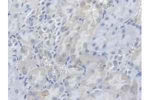 Immunohistochemistry (IHC) image for anti-phosphofructokinase, Muscle (PFKM) (AA 2-390) antibody (ABIN7435508)