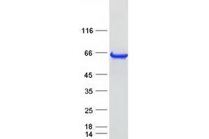 Validation with Western Blot