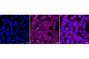 Immunocytochemical staining of HeLa cells with Phospho-mTOR (S(ABIN7800001) antibody (ABIN7799348), 1:1,000). (Recombinant MTOR antibody  (pSer2448))