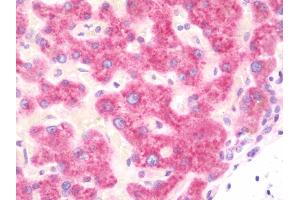 Anti-SMPD1 / Acid Sphingomyelinase antibody IHC staining of human liver. (SMPD1 antibody  (AA 391-419))