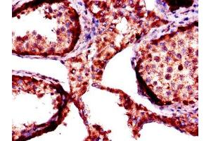 Immunohistochemistry of paraffin-embedded human testis tissue using ABIN7156155 at dilution of 1:100 (FKBP6 antibody  (AA 101-327))
