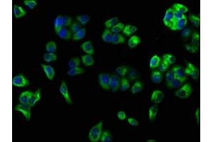 Immunofluorescence staining of PC-3 cells with ABIN7147166 at 1:100, counter-stained with DAPI. (CD59 antibody  (AA 26-102))