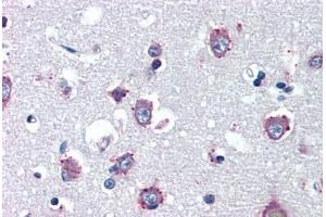 Human Brain, Cortex (formalin-fixed, paraffin-embedded) stained with NPC1 antibody ABIN462125 followed by biotinylated anti-mouse IgG secondary antibody ABIN481714, alkaline phosphatase-streptavidin and chromogen. (NPC1 antibody)