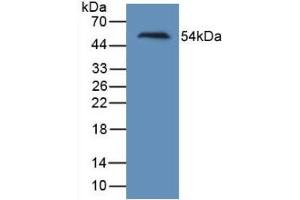 HAVCR1 anticorps  (AA 21-240)