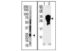 Image no. 1 for anti-Ubiquitin-Conjugating Enzyme E2S (UBE2S) (C-Term) antibody (ABIN357498) (UBE2S antibody  (C-Term))