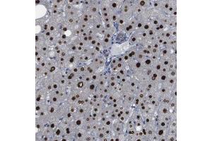 Immunohistochemical staining (Formalin-fixed paraffin-embedded sections) of human liver with PTPN1 polyclonal antibody  shows strong nuclear positivity in hepatocytes. (PTPN1 antibody  (AA 268-406))