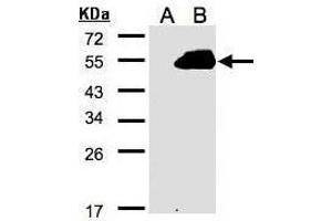 WB Image Western Blot analysis of RASSF9 expression in transfected 293T cell line by RASSF9 polyclonal antibody. (RASSF9 antibody  (C-Term))