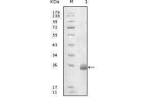 Western blot analysis using FBLN5 mouse mAb against truncated FBLN5-His recombinant protein. (Fibulin 5 antibody)