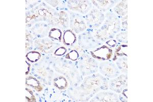 Immunohistochemistry of paraffin-embedded rat kidney using HSP70/HSP Rabbit pAb  at dilution of 1:100 (40x lens). (HSP70 1A antibody  (C-Term))