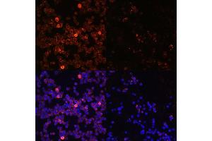 Immunofluorescence analysis of Jurkat cells using Phospho-Z-Y493 Rabbit pAb (ABIN3020534, ABIN3020535, ABIN3020536, ABIN1682145 and ABIN1682146) at dilution of 1:100 (40x lens). (ZAP70 antibody  (pTyr493))