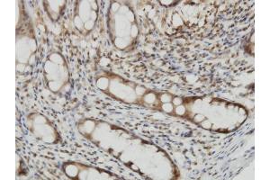 Immunoperoxidase of monoclonal antibody to CYTH2 on formalin-fixed paraffin-embedded human colon. (Cytohesin 2 antibody  (AA 314-398))