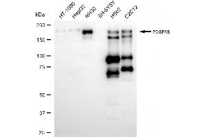 Western blotting analysis using PDGFRB antibody (ABIN7799848). (Recombinant PDGFRB antibody)