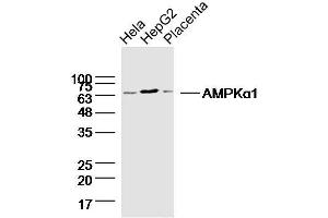 Lane1: HeLa lysates Lane 2: HepG2 lysates Lane 3: mouse placenta lysates probed with AMPK alpha-1 Polyclonal Antibody, Unconjugated  at 1:300 dilution and 4˚C overnight incubation. (PRKAA1 antibody)