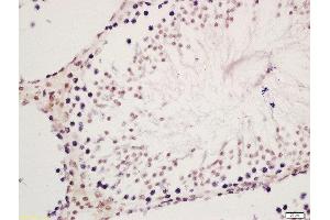 Formalin-fixed and paraffin embedded rat testis labeled with Rabbit Anti-METTL11A Polyclonal Antibody, Unconjugated (ABIN761786) at 1:200 followed by conjugation to the secondary antibody and DAB staining (METTL11A antibody  (AA 25-130))