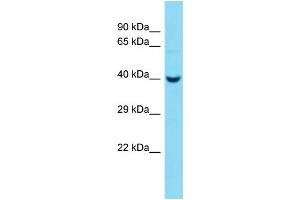 Host:  Rabbit  Target Name:  Pcmtd2  Sample Type:  Mouse Liver lysates  Antibody Dilution:  1. (PCMTD2 antibody  (C-Term))