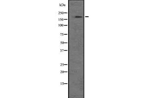 Western blot analysis of NRK expression in A549 cell line lysate ,The lane on the left is treated with the antigen-specific peptide. (NRK antibody)