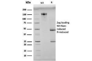 SDS-PAGE Analysis Purified N-Cadherin Mouse Monoclonal Antibody (8C11). (N-Cadherin antibody  (Extracellular Domain))