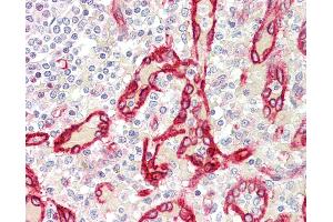Anti-SDR / SDPR antibody IHC staining of human spleen. (SDPR antibody  (C-Term))