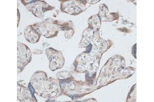 Immunohistochemistry of paraffin-embedded Human placenta using KRT7 Polyclonal Antibody at dilution of 1:100 (40x lens). (Cytokeratin 7 antibody)