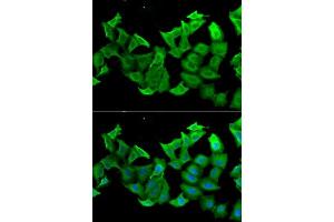 Immunofluorescence analysis of A549 cells using HAGH antibody.