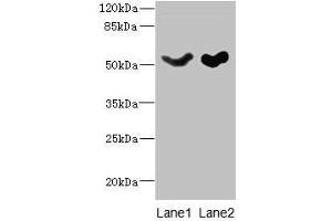 Western blot All lanes: SLC25A25 antibody at 10 μg/mL Lane 1: Mouse liver tissue Lane 2: Mouse brain tissue Secondary Goat polyclonal to rabbit IgG at 1/10000 dilution Predicted band size: 53, 56, 57, 55, 41 kDa Observed band size: 53 kDa (SLC25A25 antibody  (AA 1-189))