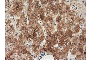 Image no. 12 for anti-Nonhomologous End-Joining Factor 1 (NHEJ1) antibody (ABIN1499729) (NHEJ1 antibody)