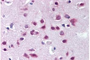Human Brain, Cortex (formalin-fixed, paraffin-embedded) stained with UBA6 antibody ABIN290255 at 10 ug/ml followed by biotinylated goat anti-rabbit IgG secondary antibody ABIN481713, alkaline phosphatase-streptavidin and chromogen. (UBA6 antibody  (AA 300-350))