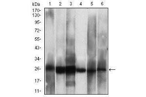 Western blot analysis using CSNK2B mouse mAb against Hela (1), Jurkat (2), C6 (3), MCF-7 (4), SK-N-SH (5), NTERA-2 (6) cell lysate. (CSNK2B antibody  (AA 1-215))